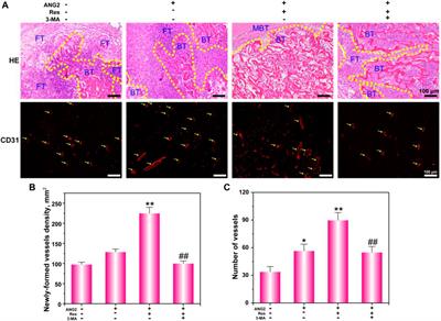 Resveratrol and Angiogenin-2 Combined With PEGDA/TCS Hydrogel for the Targeted Therapy of Hypoxic Bone Defects via Activation of the Autophagy Pathway